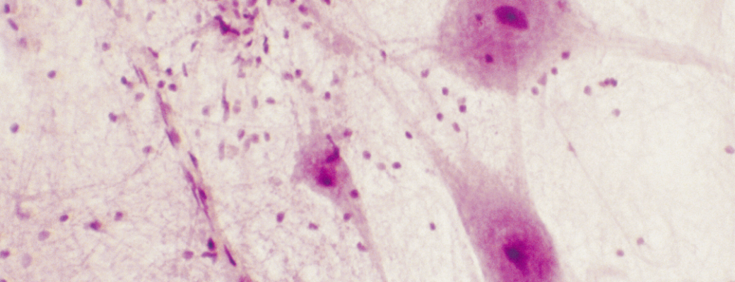 5xmille AIPAMM - post (3)