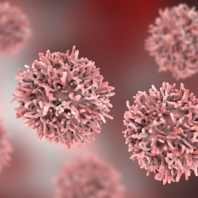 Perché le mieloproliferative croniche sono neoplasie?